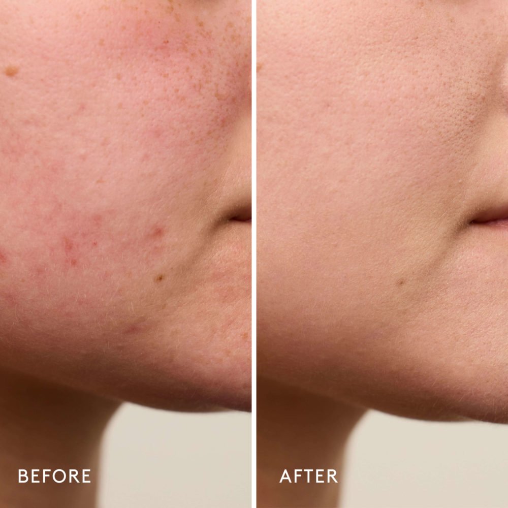 Invisible Bandage Soothing & Repairing Gel - Image 3